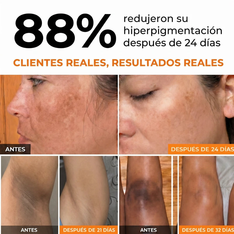 Jabón Aclarante | NutraBioLife