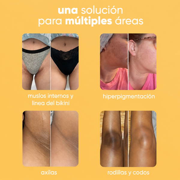 Jabón Iluminador de Cúrcuma y Limón