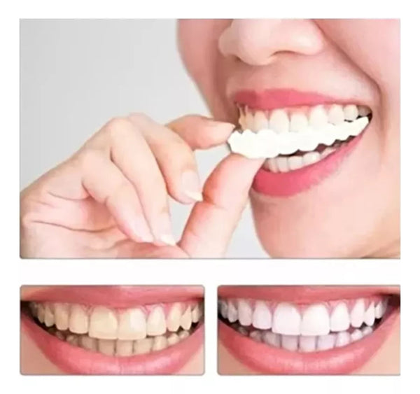 Sonrisa Perfecta en Casa