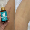 2x1 Sadoer Serum Reparador  de Cicatrices