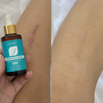 2x1 Sadoer Serum Reparador  de Cicatrices